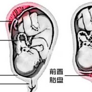 胎儿胎盘图（胎盘的结构是什么）