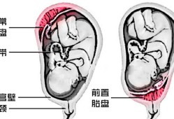 胎儿胎盘图（胎盘的结构是什么）