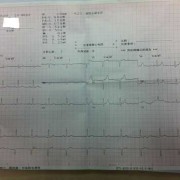 胎儿22周心率欠齐，26检查做心超好的,胎儿心律齐代表什么