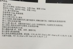 四维胎儿左心室点状强回声（无创dna低风险，四维左心多发点状强回声）