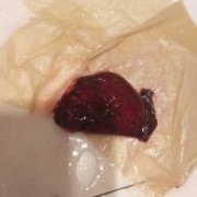 怀孕期间血块（怀孕期间血块像块肉一样是什么）