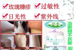 孕妇能用哪些止痒药,孕期过敏性皮炎瘙痒怎么办