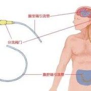 备孕期可以做指甲吗（脑级水手术后能要孩子吗）