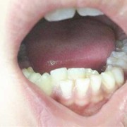 孩子有两周岁了牙齿只有12颗正常吗,胎儿正常心率是多少正常