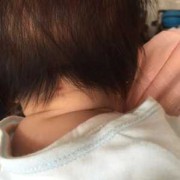 椭圆形胎儿脑袋丑死了（胎儿椭圆形头聪明）