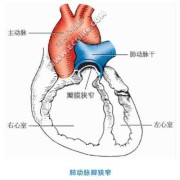 六个月胎儿肺动脉狭窄（什么是先天性肺动脉瓣狭窄）