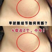 甲功亢进对胎儿有影响吗,孕期甲状腺结节对胎儿有影响吗