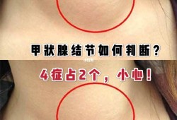 甲功亢进对胎儿有影响吗,孕期甲状腺结节对胎儿有影响吗
