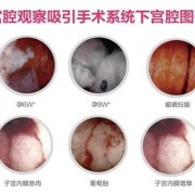 孕期怎么确定宫腔感染（宫腔内感染怎么治疗）
