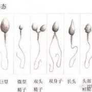 胎儿畸形与精子有关吗（胎儿畸形与精子有关吗）