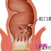 孕期痔疮肉球（孕妇怀孕期间肛门长了一个肉疙瘩，不痛也不痒是怎么回事）