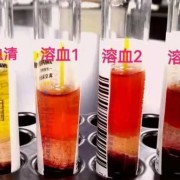 做胎儿溶血检查必须父母都去吗,孕期查溶血多少钱