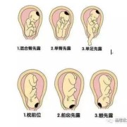 左骶前位胎儿图片（胎位左骶前是什么位置）