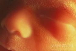 孕期手电照宝宝瞎（孕期手电照胎儿瞎）