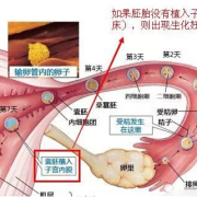 什么是生化妊娠,有什么症状,胎儿生化是怎么回事
