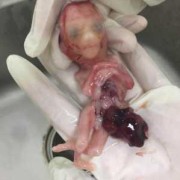 18周引产的胎儿图片（18周引产的胎儿图片）
