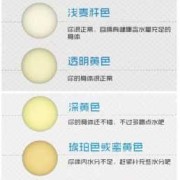 孕期尿液很黄是怎么回事,孕期尿发黄是什么原因