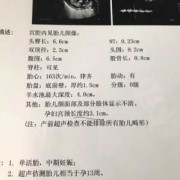 胎儿nt值正常范围（产检nt值多少正常）