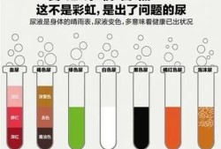 孕期尿液黄（孕期尿液黄是什么原因）