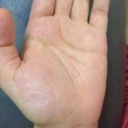孕期的脉搏（怀孕左手脉搏跳动明显）