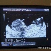 五维拍照对宝宝有影响吗,胎儿腹围小的危害有哪些