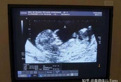 五维拍照对宝宝有影响吗,胎儿腹围小的危害有哪些