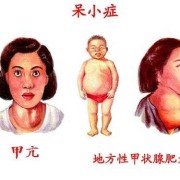 胎儿呆小症能查出来吗（胎儿呆小症能在孕检中检查出来吗?）