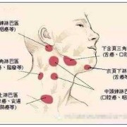 淋巴结肿大是怎么回事，淋巴结肿大的原因有哪些,怀孕期间淋巴结肿大怎么办