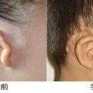 宝宝耳朵怎么会畸形的啊？怀孕期间需要注意哪些呢,检查胎儿畸形的方法有哪些