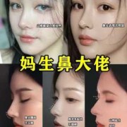 婴儿鼻型如何判断鼻梁高,胎儿鼻子高是男孩女孩