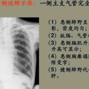 胎儿肺不张（胎儿肺不张）