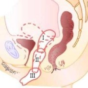 生完孩子宫颈下垂了应该怎么办,孕期宫颈下垂怎么改善