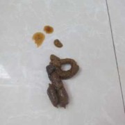 孕妇一天大便几次正常？为什么孕妇经常会大便不正常啊,孕期屎多是什么原因