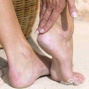 孕期脚凉怎么回事（孕期脚凉是什么原因怎么办）