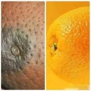 孕期乳头变黑（孕期乳头变黑了还会变回来吗?）