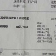 孕期血全套（孕期血全套查什么）