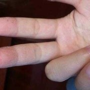 孕期手上脱皮（孕期手上脱皮是怎么回事）
