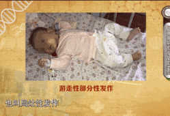 癫痫病人可以要小孩吗,