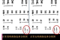染色体对胎儿的影响（染色体对胎儿的影响发生时间）
