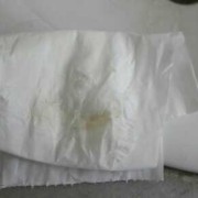 孕期灰色白带（孕期灰色白带）