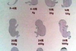 三个月的宝宝算婴儿还是儿童,胎儿的定义