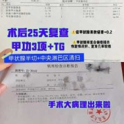 孕期甲状腺检查哪几项（甲状腺癌术后复查几项）