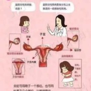 盆腔炎会影响胎儿吗（盆腔炎会影响胎儿吗）