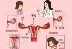 盆腔炎会影响胎儿吗（盆腔炎会影响胎儿吗）