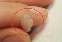怀孕14周胎儿图片欣赏（怀孕14周胎儿真实图片欣赏）