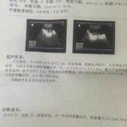 怀孕80天有孕吐反应是胎儿发育好吗？还没去做产检，上次检查,80天胎儿发育图片大全