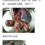 胎儿不喜欢动（快六个月了，宝宝不爱动，有一样的吗）