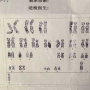 什么是胎儿染色体（胎染是什么）