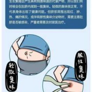 孕期肚脐臭（孕期肚脐臭是怎么回事）