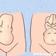 枕后位缩写,胎儿枕后位是什么意思